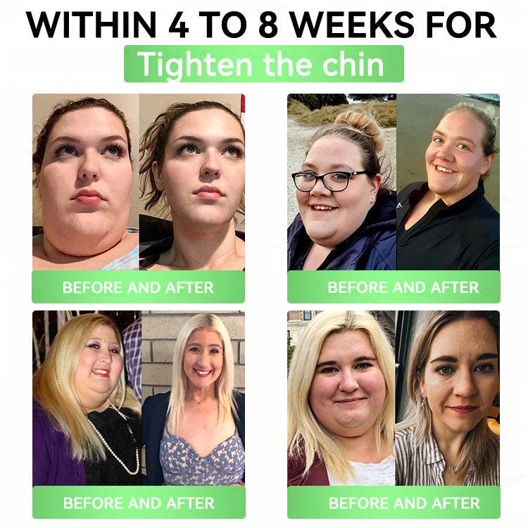 🇺🇸Alcuras™ Moringa × Berberine × AMPK 8-Benefit Slimming & Metabolic Nano Microneedle Patch✨