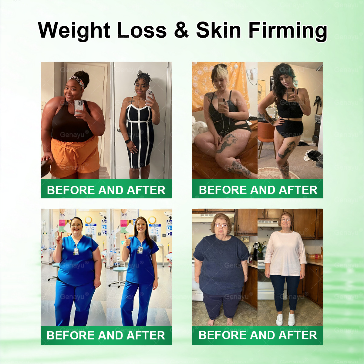 🇺🇸Alcuras™ Moringa × Berberine × AMPK 8-Benefit Slimming & Metabolic Nano Microneedle Patch✨